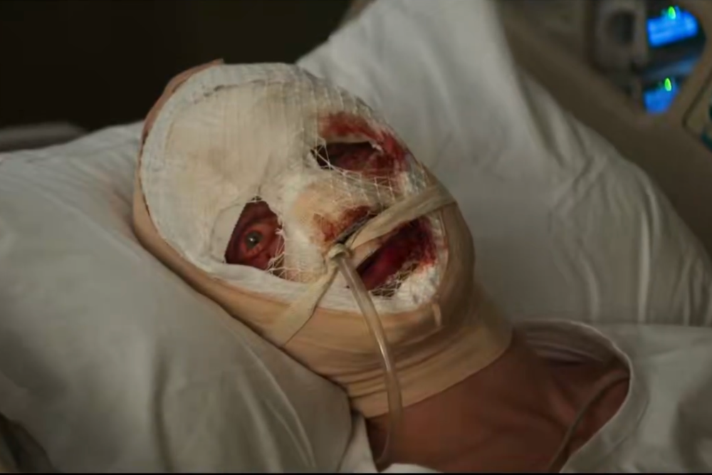 Eine Person liegt in einem Krankenhausbett, der Kopf ist fast vollständig mit blutigen Verbänden umwickelt. Nur ein Auge und der Mundbereich sind sichtbar, ein medizinischer Schlauch führt vom Mund weg.